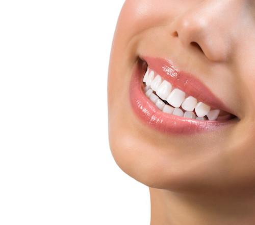 girl smiling after dental emergency in concord nh